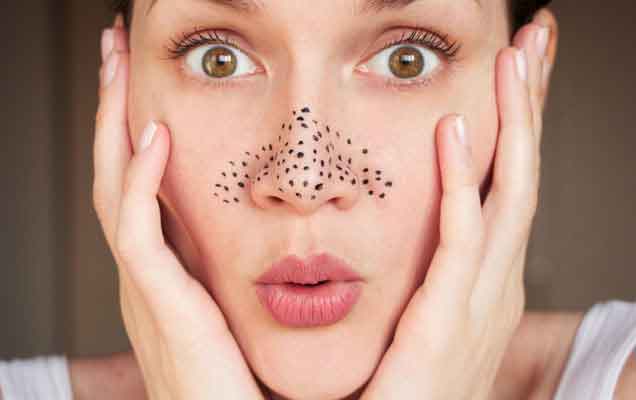 what is Blackheads causes treatments naatv telugu